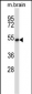 GTF2H1 Antibody (N-term)