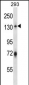 RNF20 Antibody (N-term)