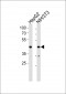 NR2F2 Antibody (N-term)