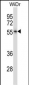 NR2E3 Antibody (Center)