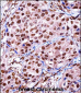 ZBTB7A Antibody (C-term)