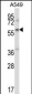 ZBTB7A Antibody (C-term)