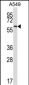 FZD5 Antibody (C-term)