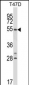 NR1D1 Antibody (Center)