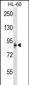 MCPH1 Antibody (N-term)