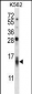 CCL15 Antibody (C-term)