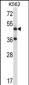 TACR3 Antibody (C-term)