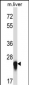 IL27 Antibody (Center)