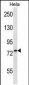 PDIA4 Antibody (N-term)