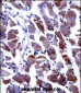 DPYSL3 Antibody (C-term)