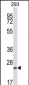 BCAP29 Antibody (C-term)