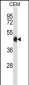 CREB5 Antibody (N-term)