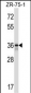 FETUB Antibody (C-term)