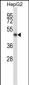 KCNK10 Antibody (C-term)