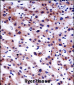 AKT1S1 Antibody (C-term)