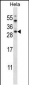 AP14275b-AKT1S1-Antibody-C-term