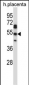 TEAD2 Antibody (Center)