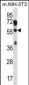 TEAD2 Antibody (Center)