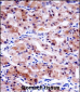 USP43 Antibody (C-term)