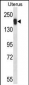 USP43 Antibody (C-term)