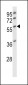 Desmin Antibody (C-term)