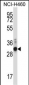 ZFPL1 Antibody (Center)