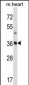 STC2 Antibody (C-term)