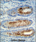 Myeloperoxidase Antibody (Center)