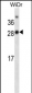 FIP200 Antibody (Center)