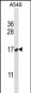 NFYB Antibody (N-term)