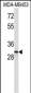 ING1 Antibody (N-term)