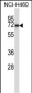 FZD9 Antibody (N-term)