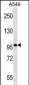 SYNPO Antibody (C-term)