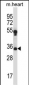 MARCH1 Antibody (Center)