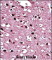 BIN1 Antibody (Center)