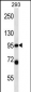 PSMD2 Antibody (N-term)