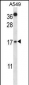 CSTA Antibody (C-term)