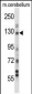 USP15 Antibody (N-term)