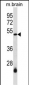 SMARCB1 Antibody (N-term)