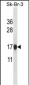 CSTB Antibody (Center)