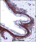 SMARCE1 Antibody (C-term)