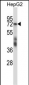 SF1 Antibody (Center)