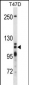 XRN2 Antibody (N-term)