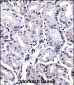 FOXP4 Antibody (C-term)