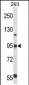 FOXP4 Antibody (C-term)