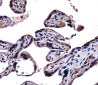 IL9R Antibody (Center)