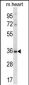 DLX5 Antibody (Center)