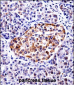 TAC3 Antibody (Center)