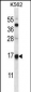 MAGOH Antibody (Center)