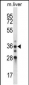 BLVRA Antibody (C-term)